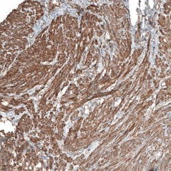 Neuropilin-2 Antibody, Novus Biologicals 25 &mu;L; Unlabeled:Antibodies,